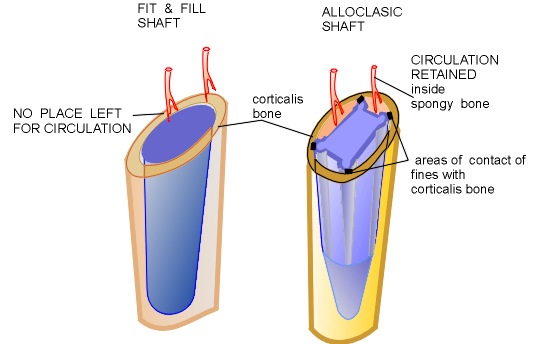ALLOCLASIC.jpg (39592 bytes)